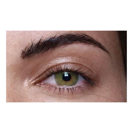 Anesthesia Anesthetic Fonesta Unisex Contact Lens